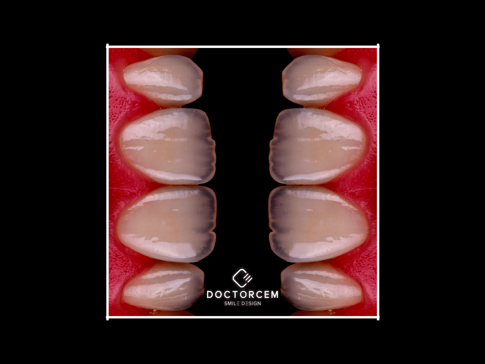 Dental technician working on a digital model