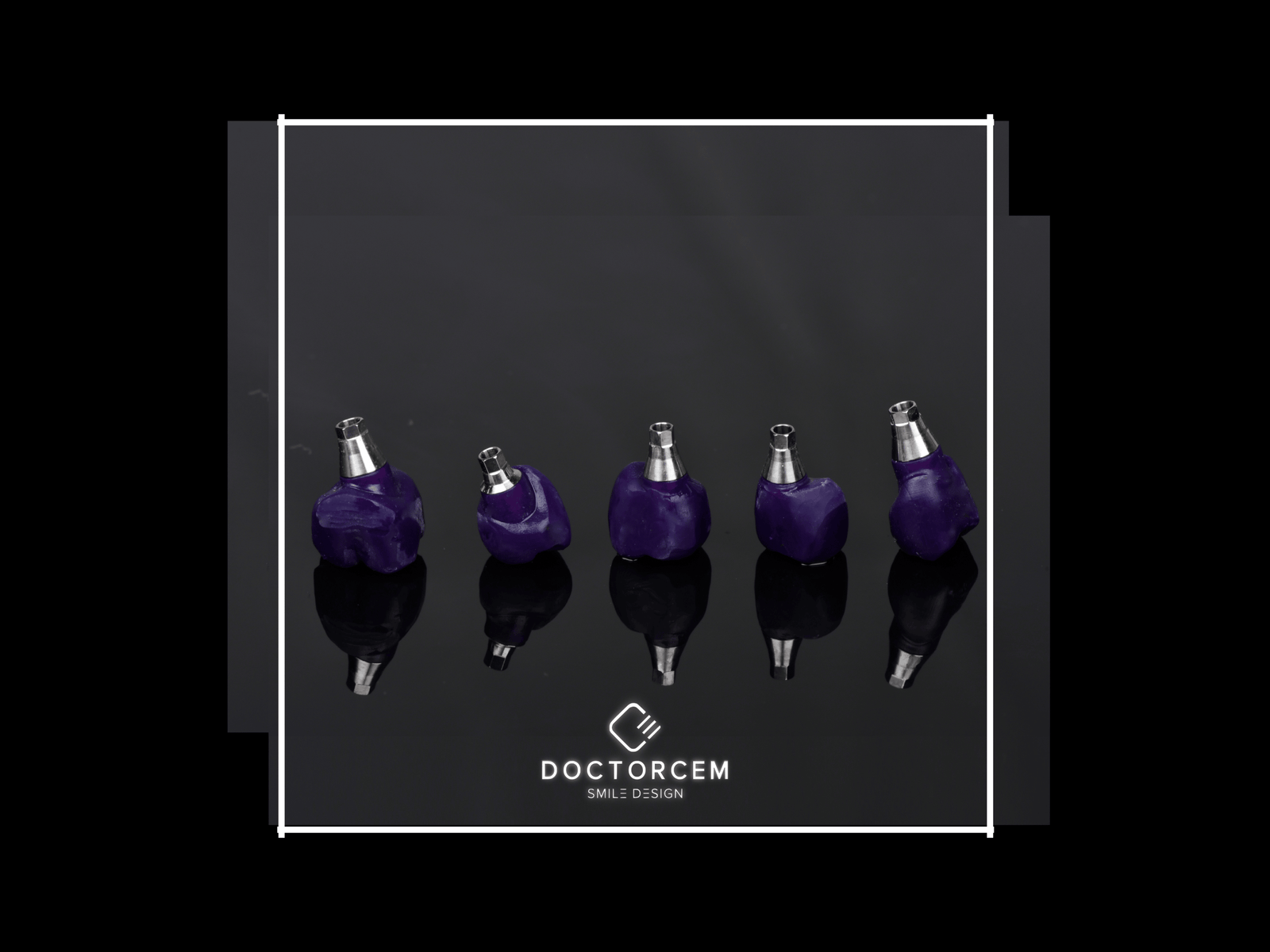 Inlay, onlay dhe overlay