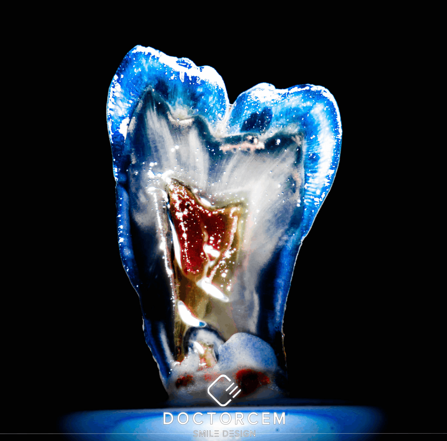 Dental technician working on a digital model
